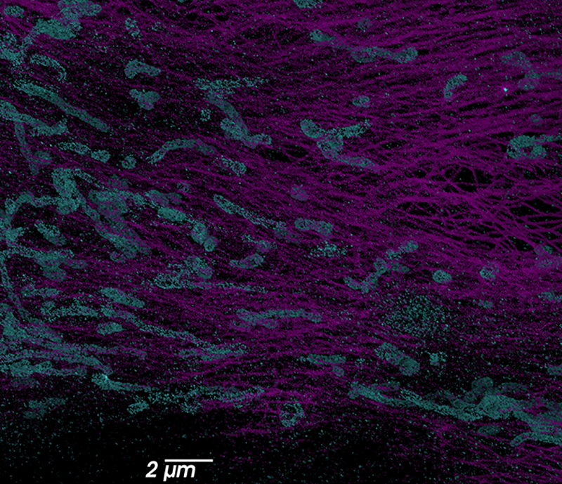 Mitochondrial and tubulin network interactions