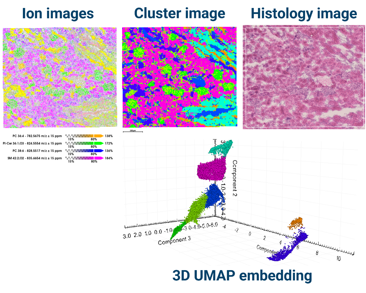 The built-in multivariate statistics module allows unsupervised spatial segmentation of MALDI Imaging data. Use the segmentation clusters to define regions of interest and identify potential biomarkers.