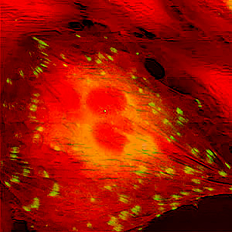  AFM image (in red) with the corresponding, calibrated optical image (yellow-green fluorescence) of living REF52 fibroblasts expressing YFP-paxillin.