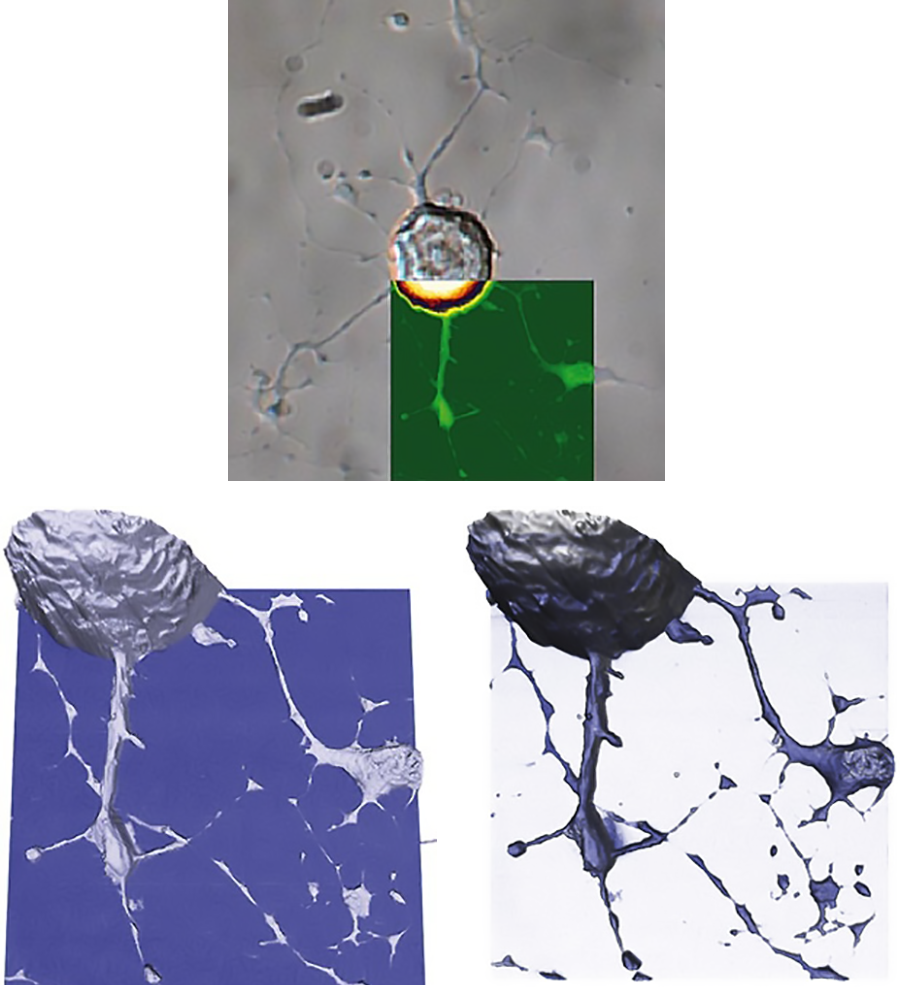 AFM images of living dorsal root ganglion cells