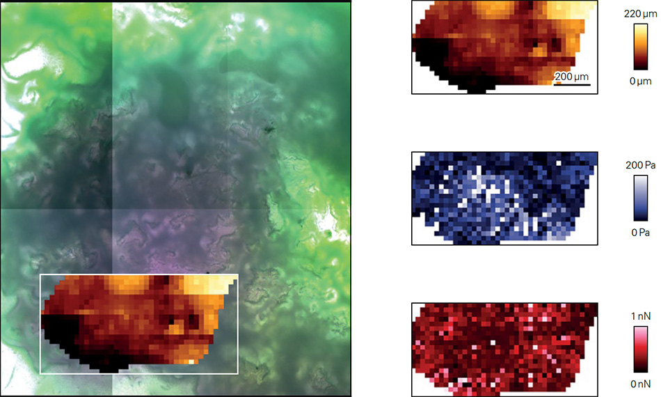 SmartMapping of neuroblastoma tissue from zebrafish: left image shows AFM topography overlay on brightfield image; right column shows AFM topography, Young’s Modulus, and adhesion maps.
