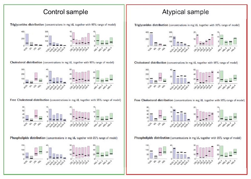 Two examples for lipid distributions calculated from Bruker IVDr Lipoprotein Subclass Analysis B.I.-LISA.