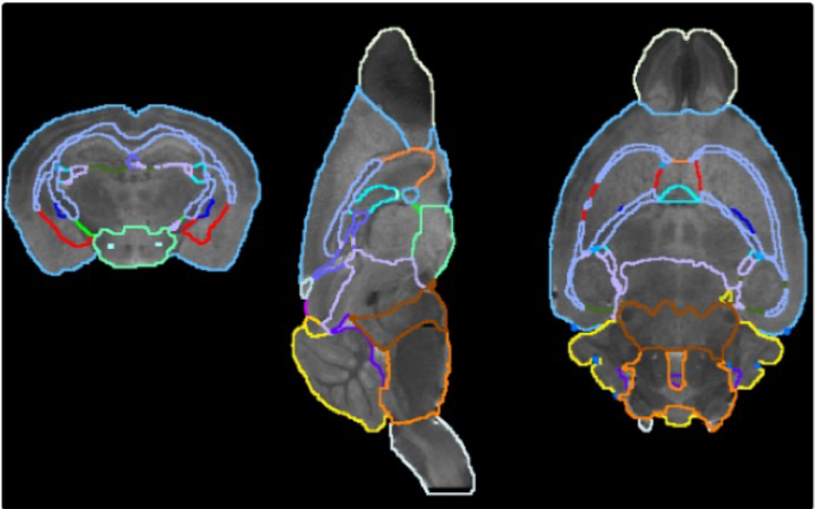 Brain atlas region