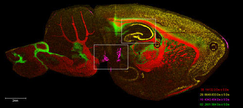 MALDI Imaging - Lipids in Brain