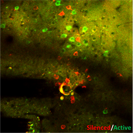 Interface of brain physiology and BRAIN Initiative Technologies