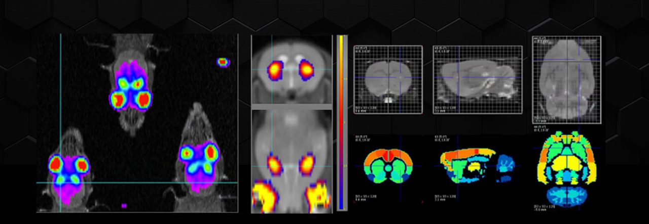 PET MRI Occupancy Studies: Basic Principles and Applications in ...