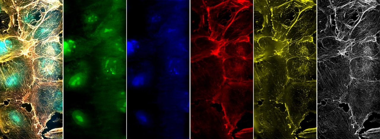 Lef-to-right: Merged image of multi-stained HELA Cells