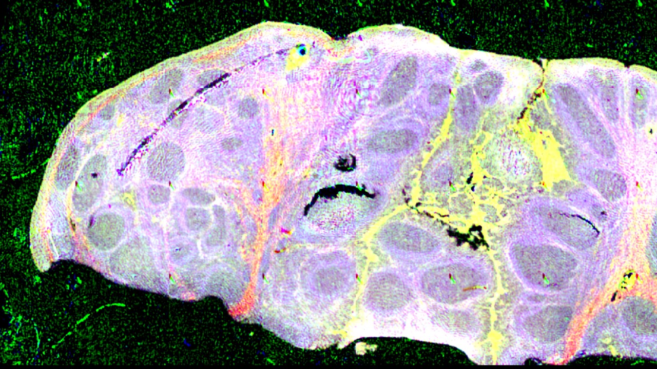 生命科学のためのQCL技術の可能性は大きい