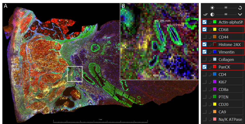 SCiLS Scope Screenshot