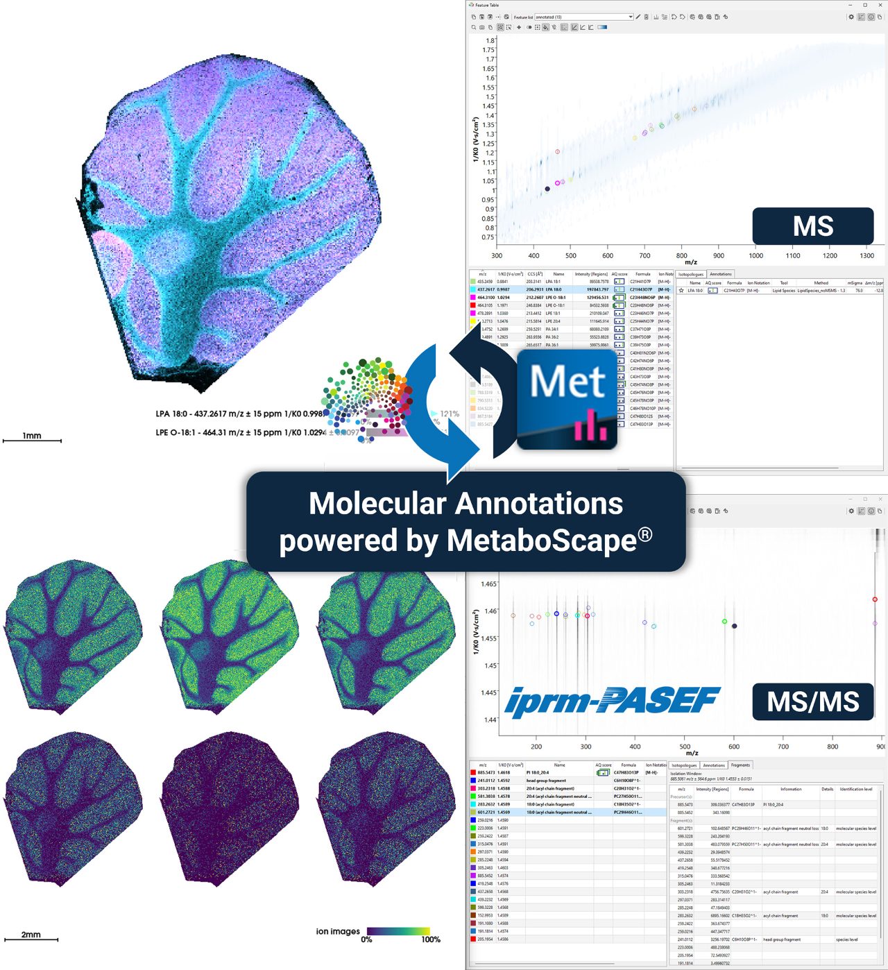 SCiLS Lab | Bruker