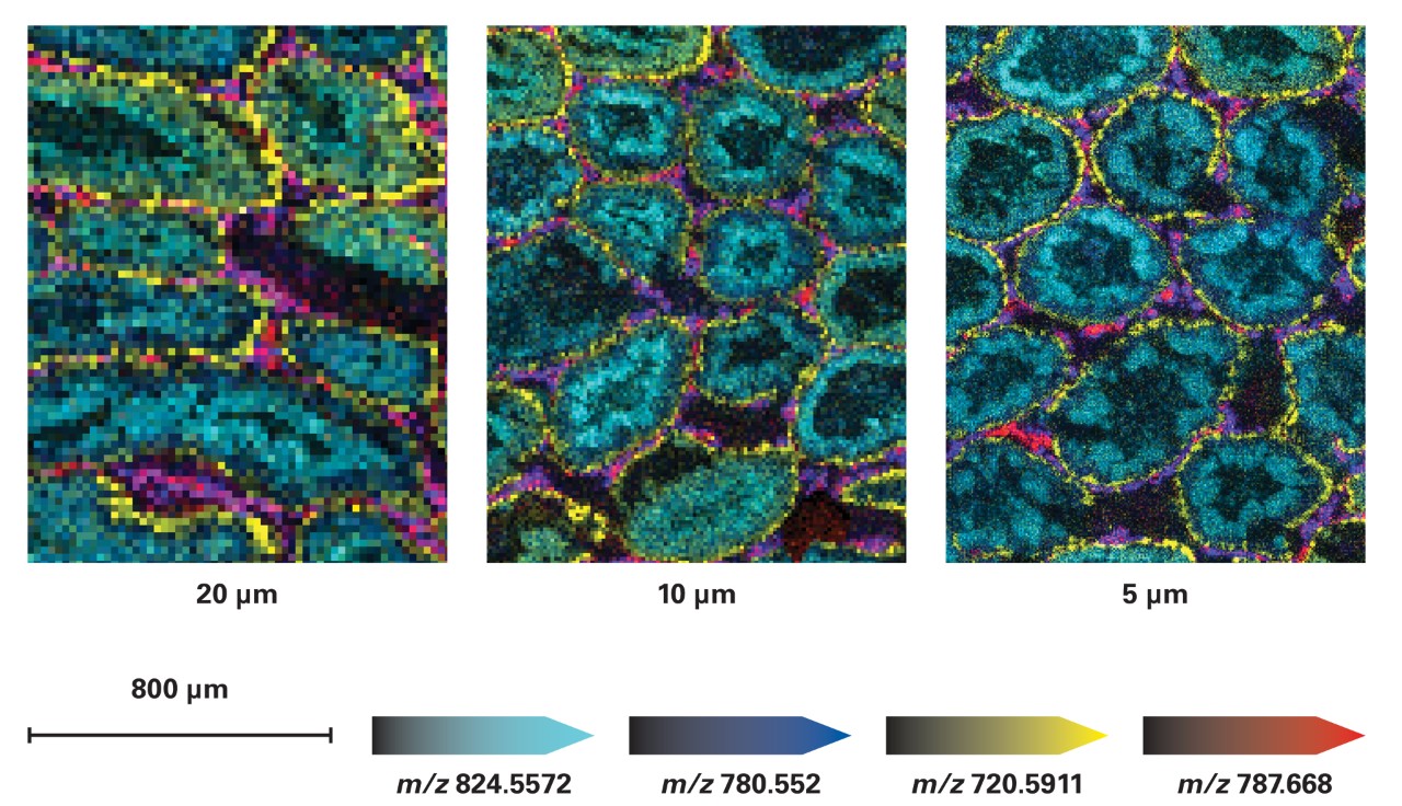 ラット精巣の画像を20μmから5μmに解像度を向上させたmicroGRIDイメージングにより、臓器の微細な組織構造にアクセスすることができます。