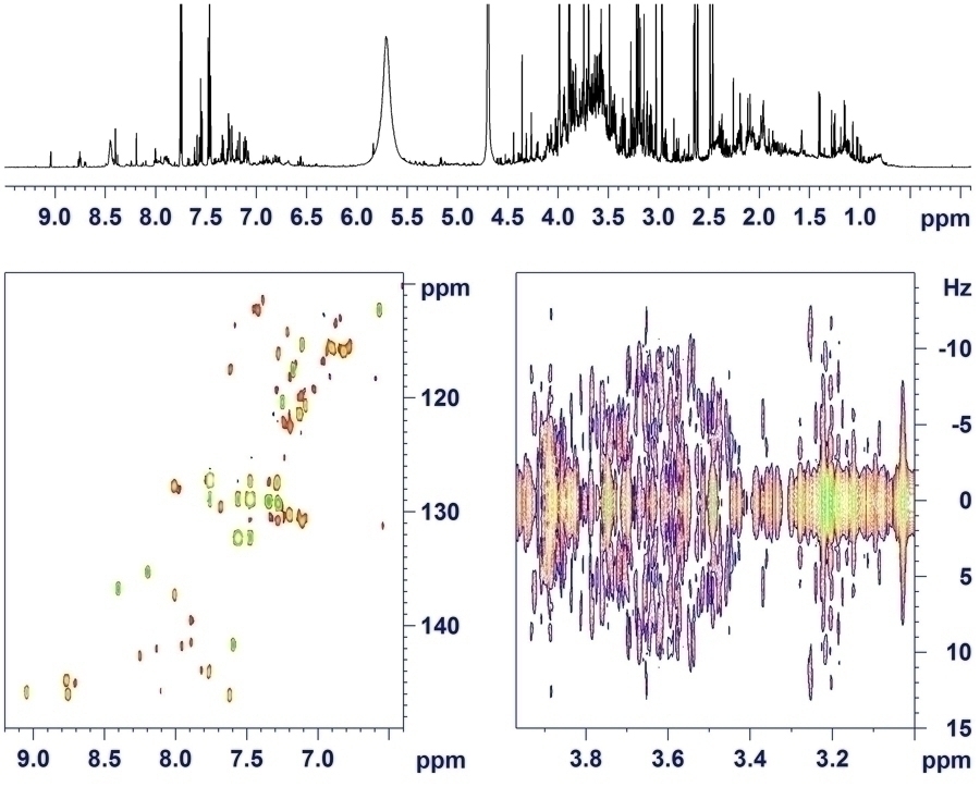 350 µl unbuffered male urine in shaped sample tube Top: Presat ns = 8 Left: HSQC aromatic region Right: 2D J-RES aliphatic region