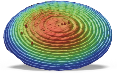 Diffractive Surface of a Bifocal Contact Lens