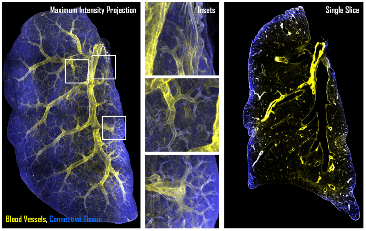 Luxendo Light-Sheet images of a lung taken with the LCS SPIM.