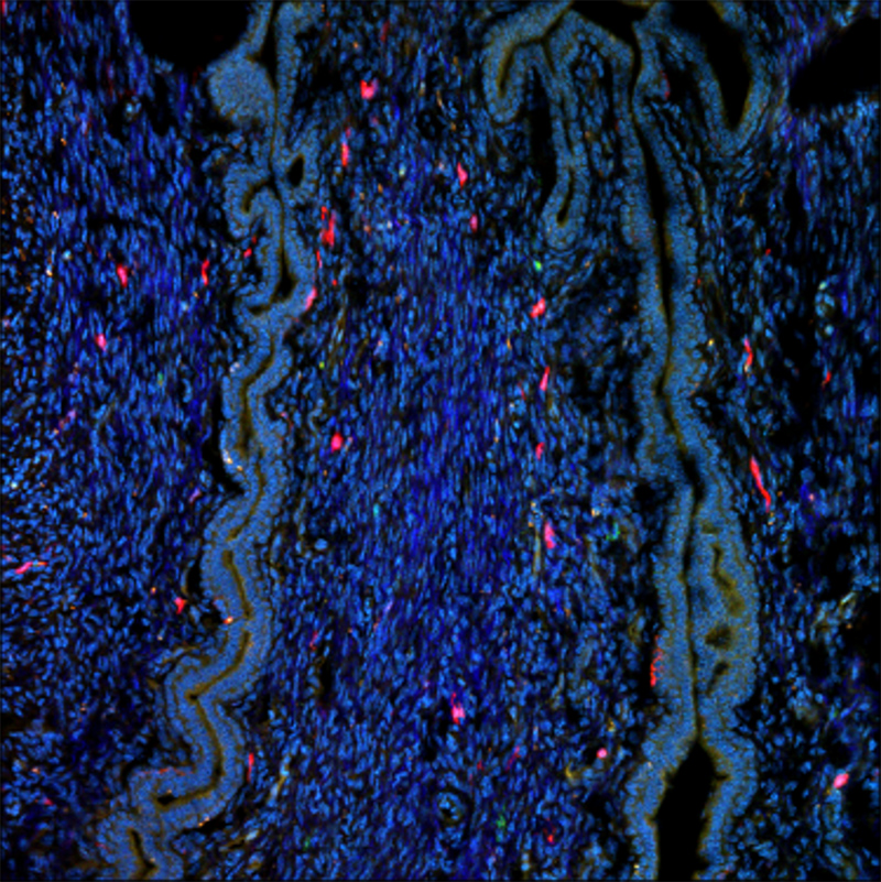 Epithelial cells visualized with autofluorescence signal (green/turquois hue)