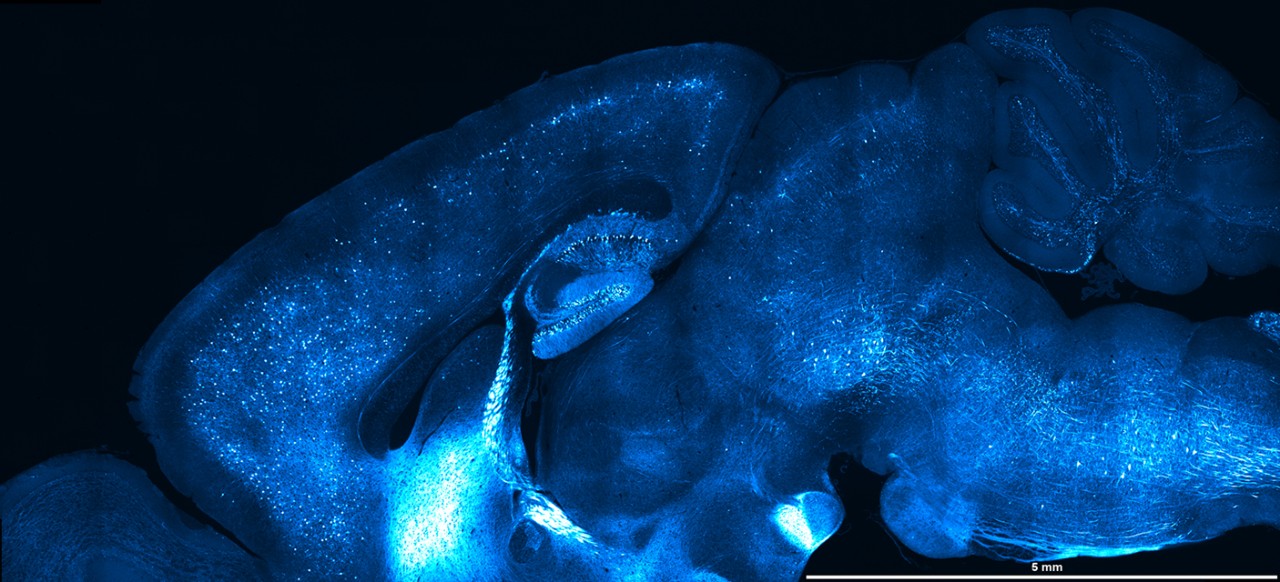 Large FOV montage of hippocampal slice and details of selected tile