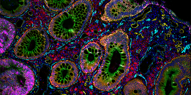 Bruker Spatial Biology CellScape | Bruker