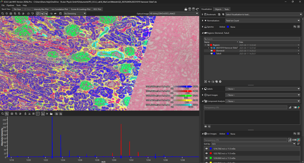SCiLS Lab is the industry’s tool of choice for deriving new insights from mass spectrometry imaging data. Used across science and industry, the software sets new standards in analysis and visualization, simplifying everyday work and boosting research output.