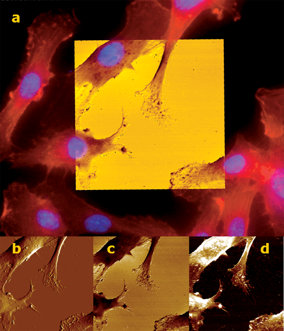 Photo collage showing Overlay of fluorescence and AFM images of living HUVEC cells created with MIRO on a BioScope Catalyst. The main benefit of MIRO is to enable the display of optical and AFM information simultaneously