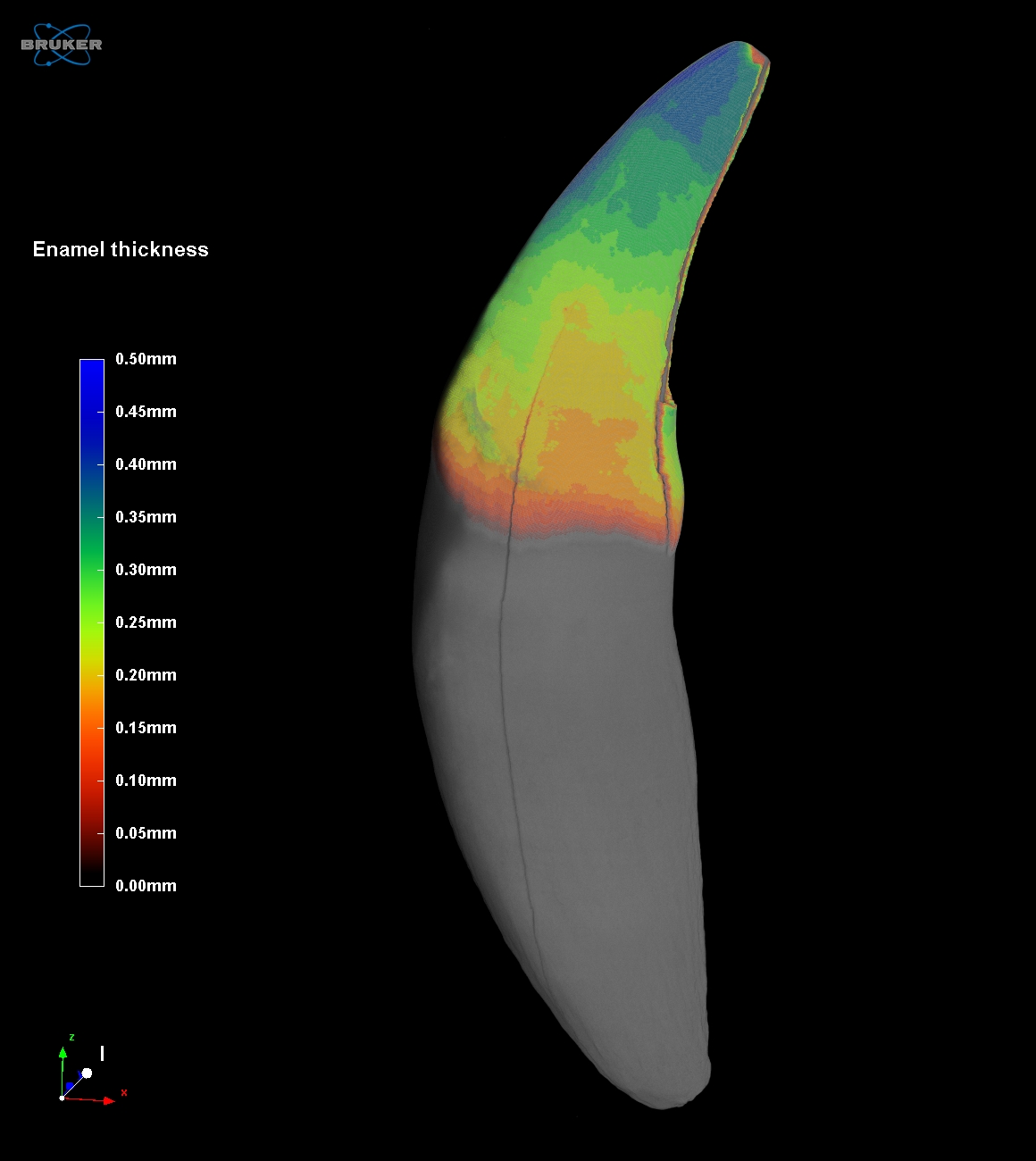 High Capacity 3D X-ray Microscopy | Solutions | SKYSCAN 1273 | Bruker