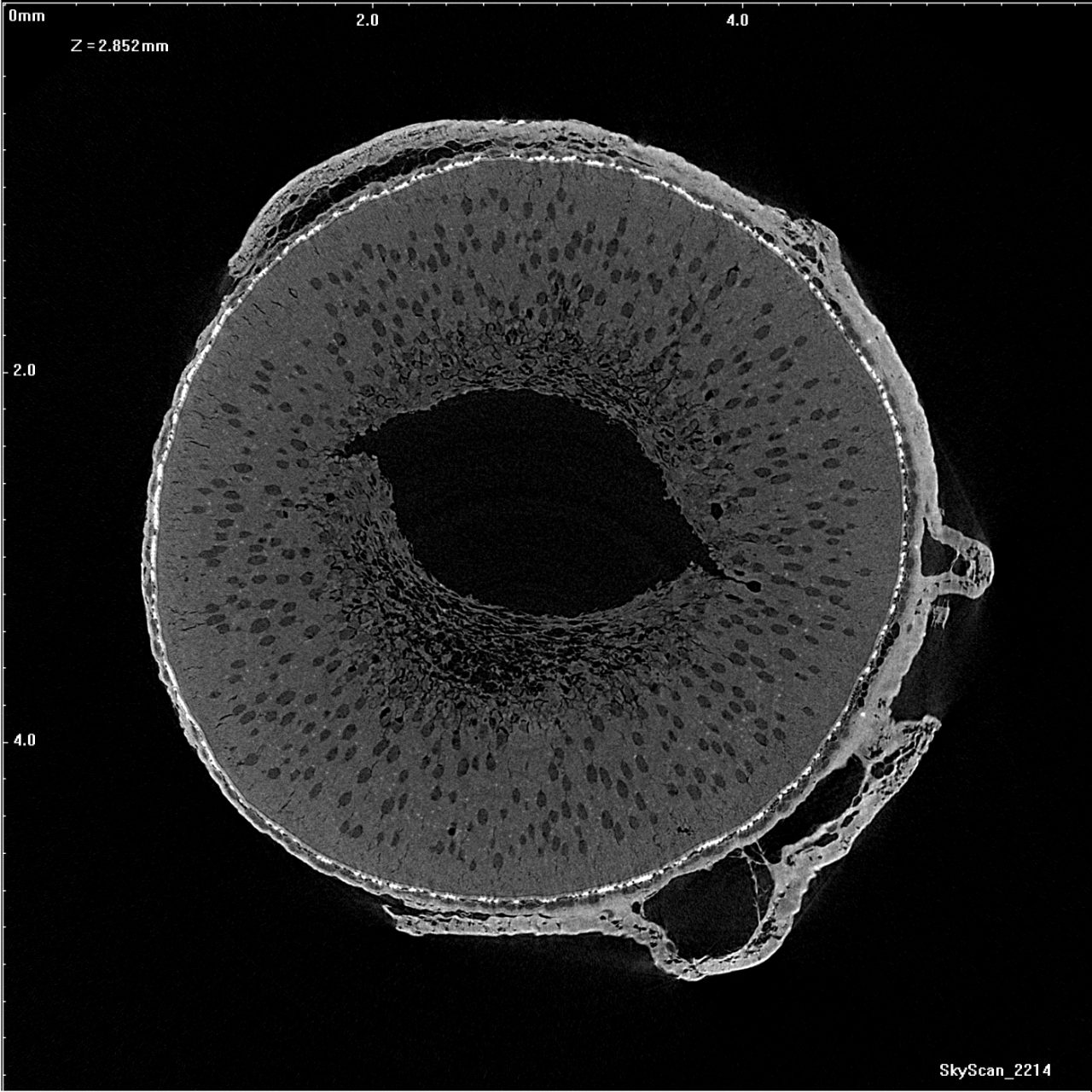 Nanoscale 3D X-ray Microscopy | Solutions | SKYSCAN 2214 | Bruker