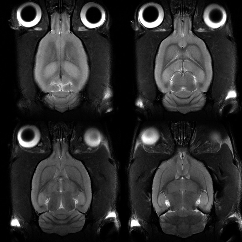 MRI Parallel Imaging