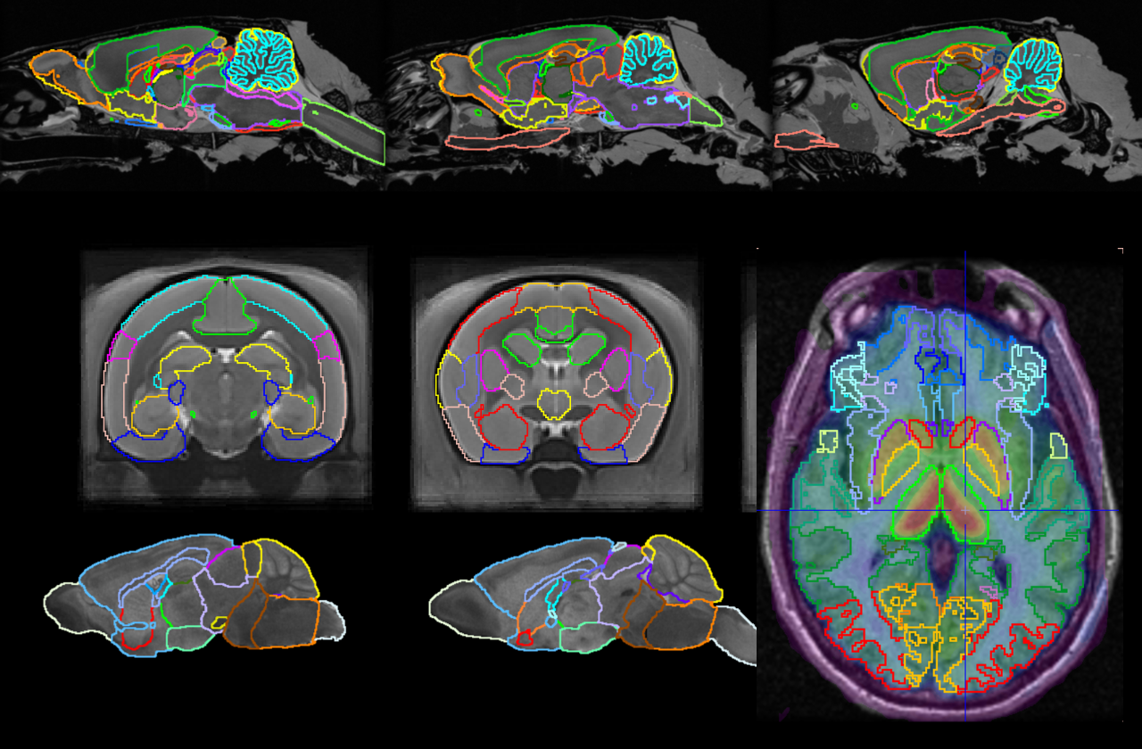 Workflow-based brain segmentation