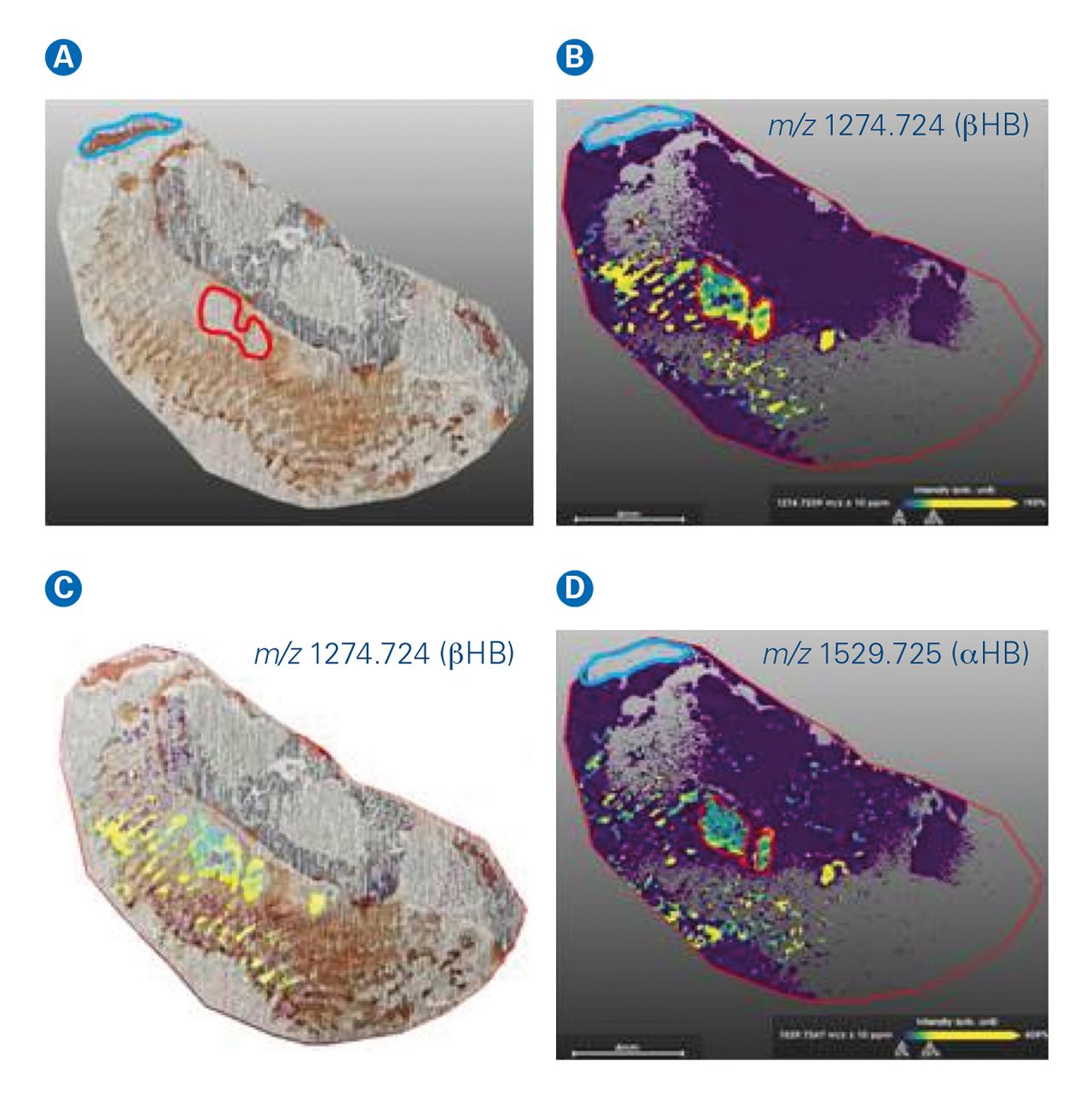 Forensic visualisation of blood provenance in old fingermarks by MALDI MS Imaging