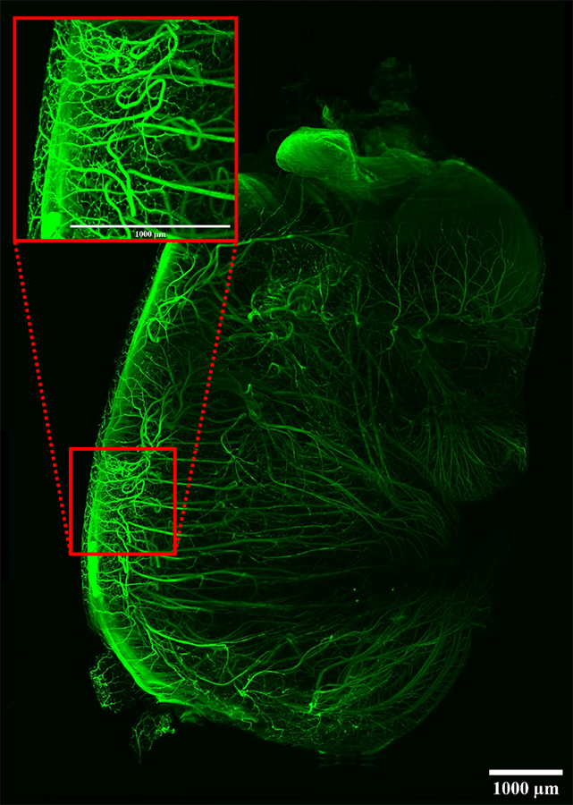 Fluorescent tiled image of developing nerves in a whole mouse embryo cleared with DBE, imaged on LCS SPIM.