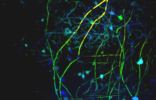 Neuronal network of a CUBIC‑cleared mouse brain stained with GFP, color‑coded depth, imaged on MuVi SPIM.