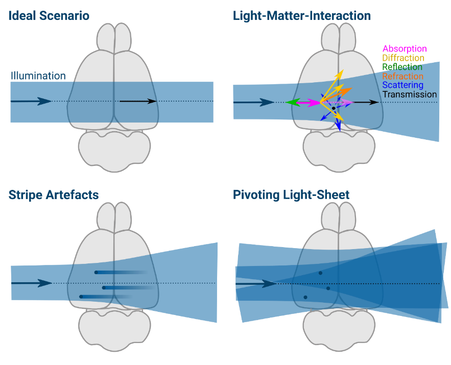 Light-Sheet Microscopy and striping artifacts mitigation