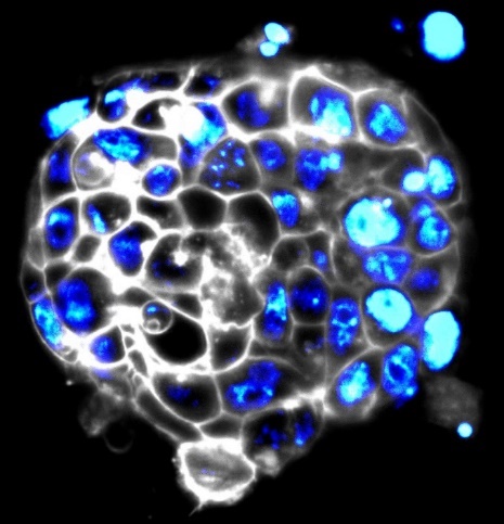 Colony of mouse embryonic stem cells with a stable nuclear (blue) and membrane marker (white).