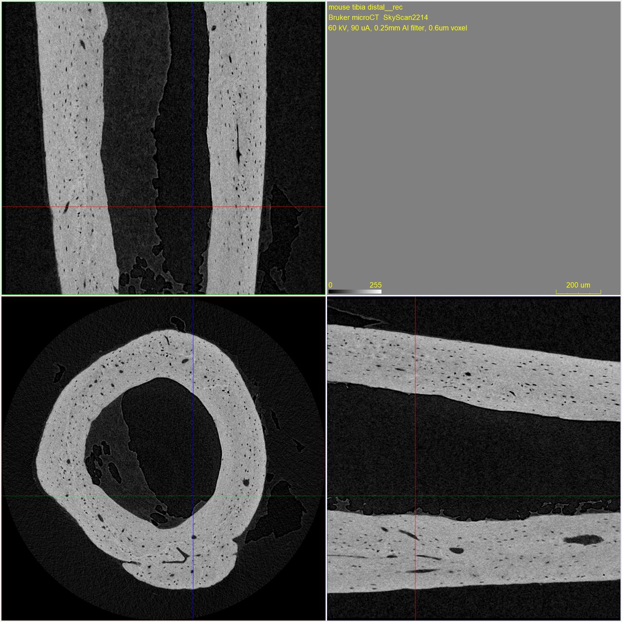 Nanoscale 3D X-ray Microscopy | Solutions | SKYSCAN 2214 | Bruker