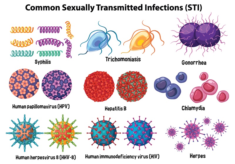 Common sexually transmitted infections (STI) - Syphilis, Gonorrhea, Trichomoniasis, Human papillomavirus (HPV), Hepatitis B, Chlamydia, Human herpesvirus 8 (HHV-8), Human immunodeficiency virus (HIV), Herpes