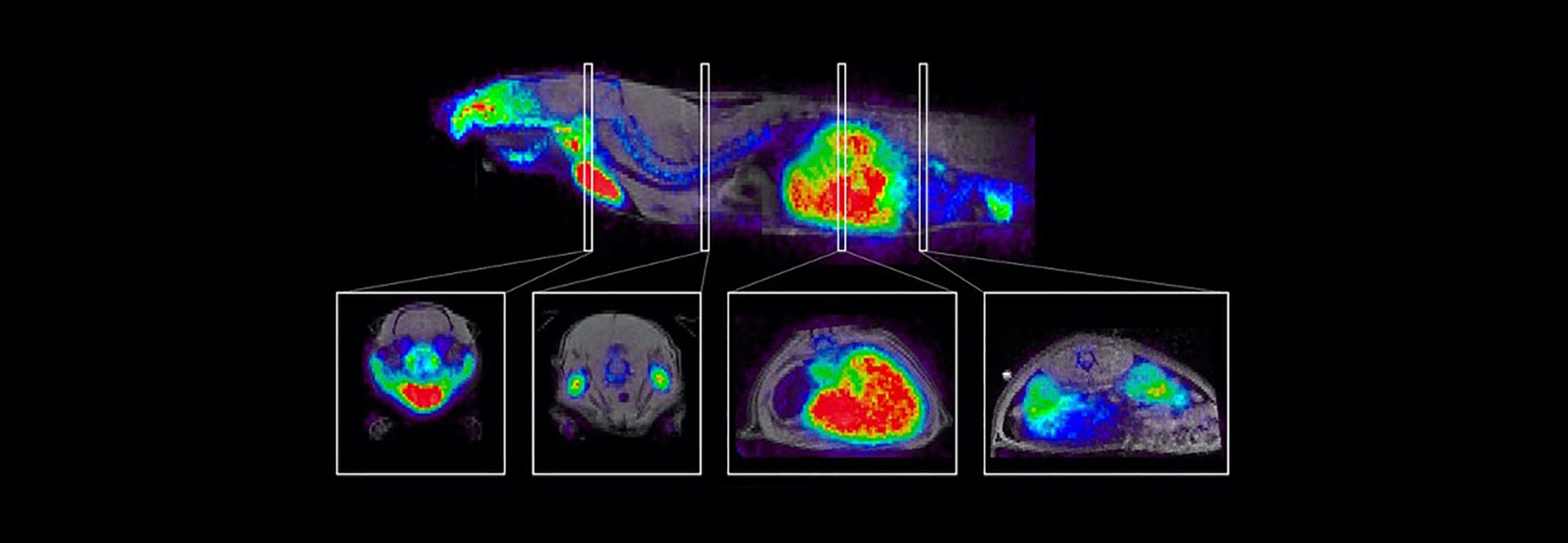 Accessing Liver Diseases with Multiparametric PET/MR