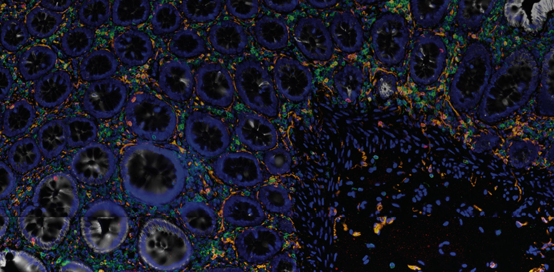 spatial-omics