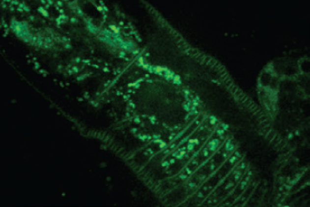 C. elegans labeled with GFP