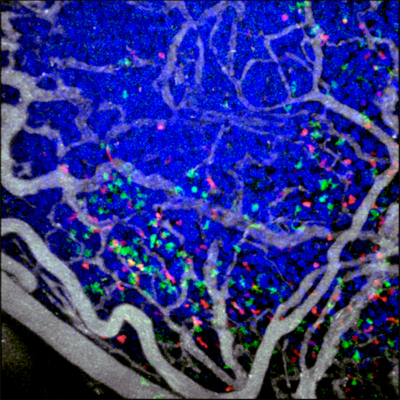GFP-expressing cytotoxic T lymphocytes (green) and tdTomato-expressing regulatory T cells (red) infiltrating a mouse colon carcinoma implanted into a dorsal skinfold chamber. Tumor cell nuclei (blue) are tagged through expression of a Cerulean-histone H2B fusion protein. Blood vessels (white) are highlighted through intravenous injection.