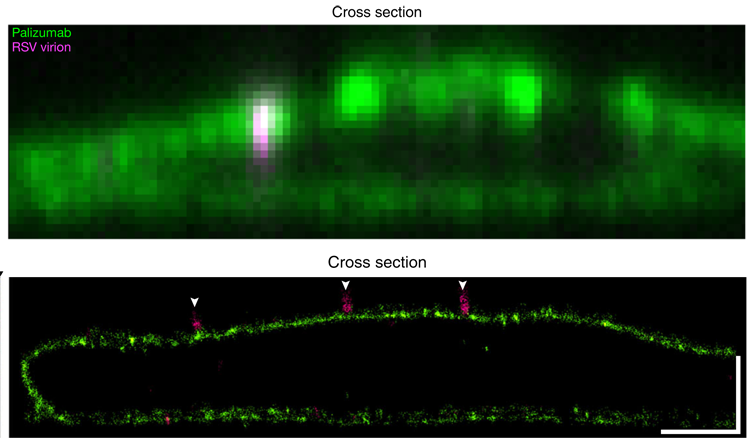 Palivizumab expressing Vero cells