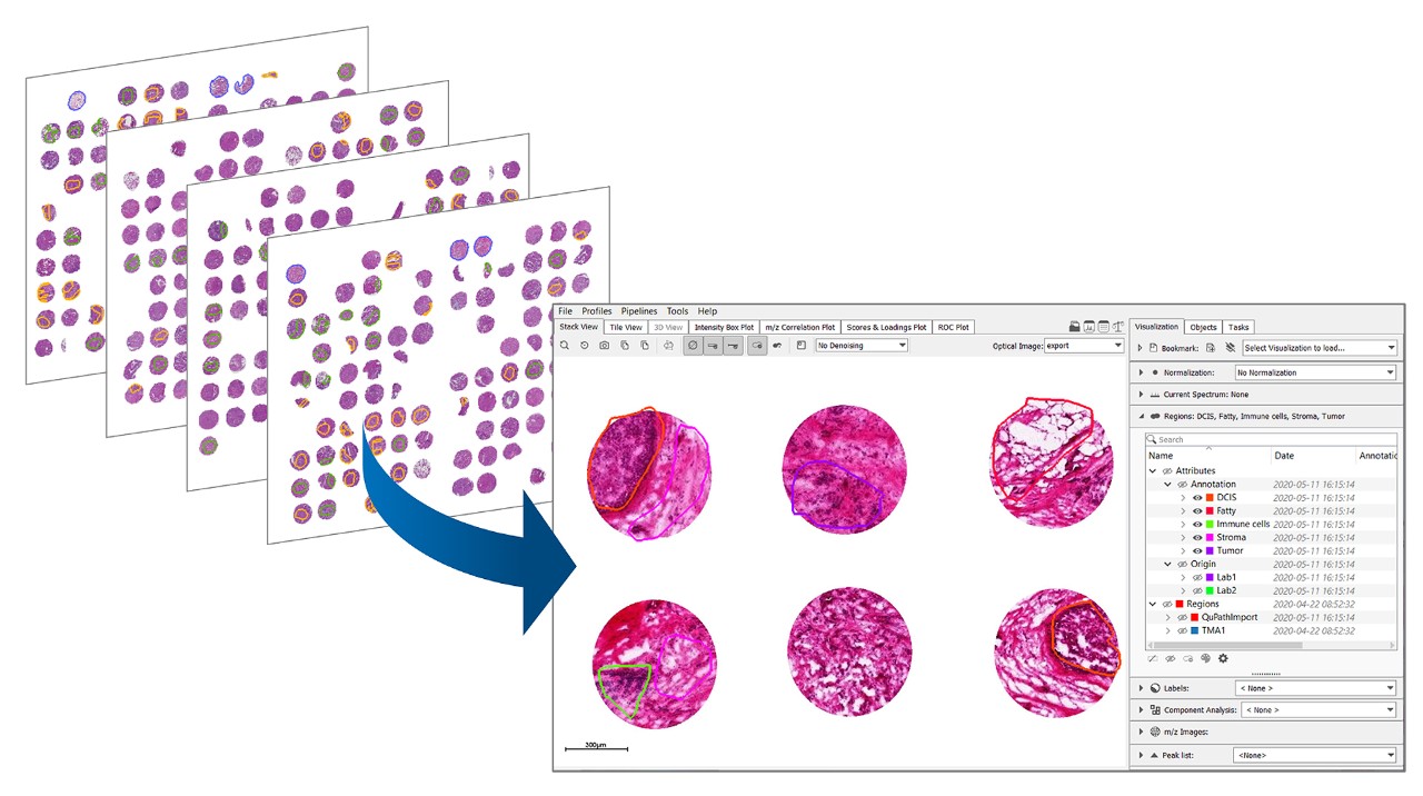 Statistical analysis with SCiLS Lab: Automatically group samples according to metadata provided with experiments – perform classification and prediction with machine learning methods for tissue typing or biomarker discovery. ​