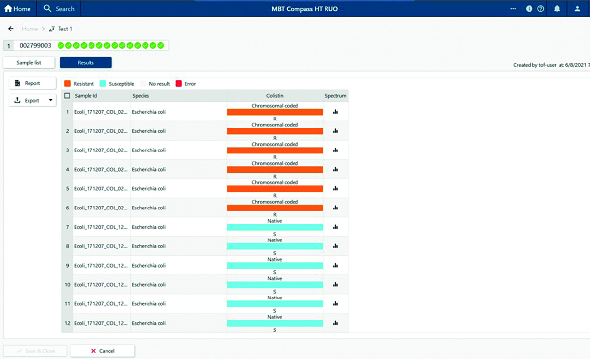 Example software results for lipid test