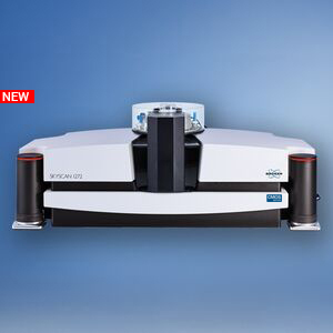 High Resolution 3D X-ray Microscopy | Solutions | Bruker