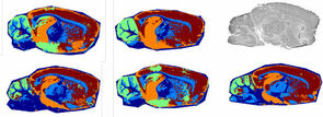 Segmentation analysis of five serial rat brain sections