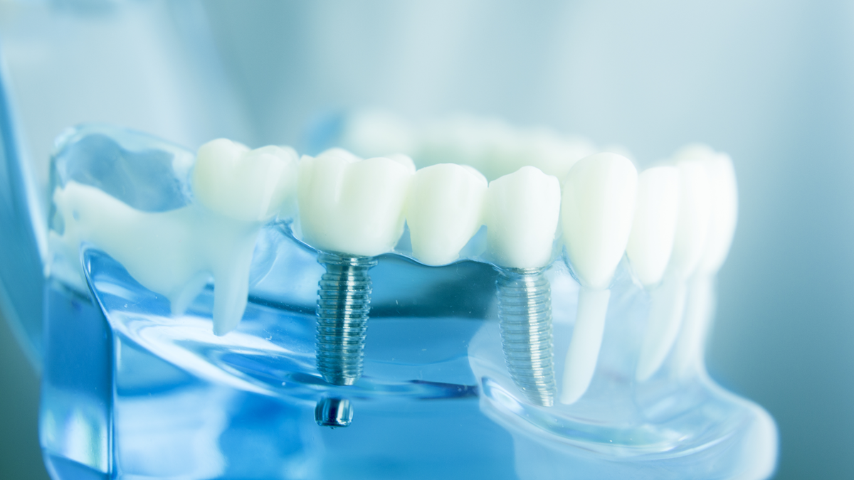 Dental Implants Bruker
