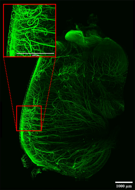 Developing nerves in a whole mouse embryo.