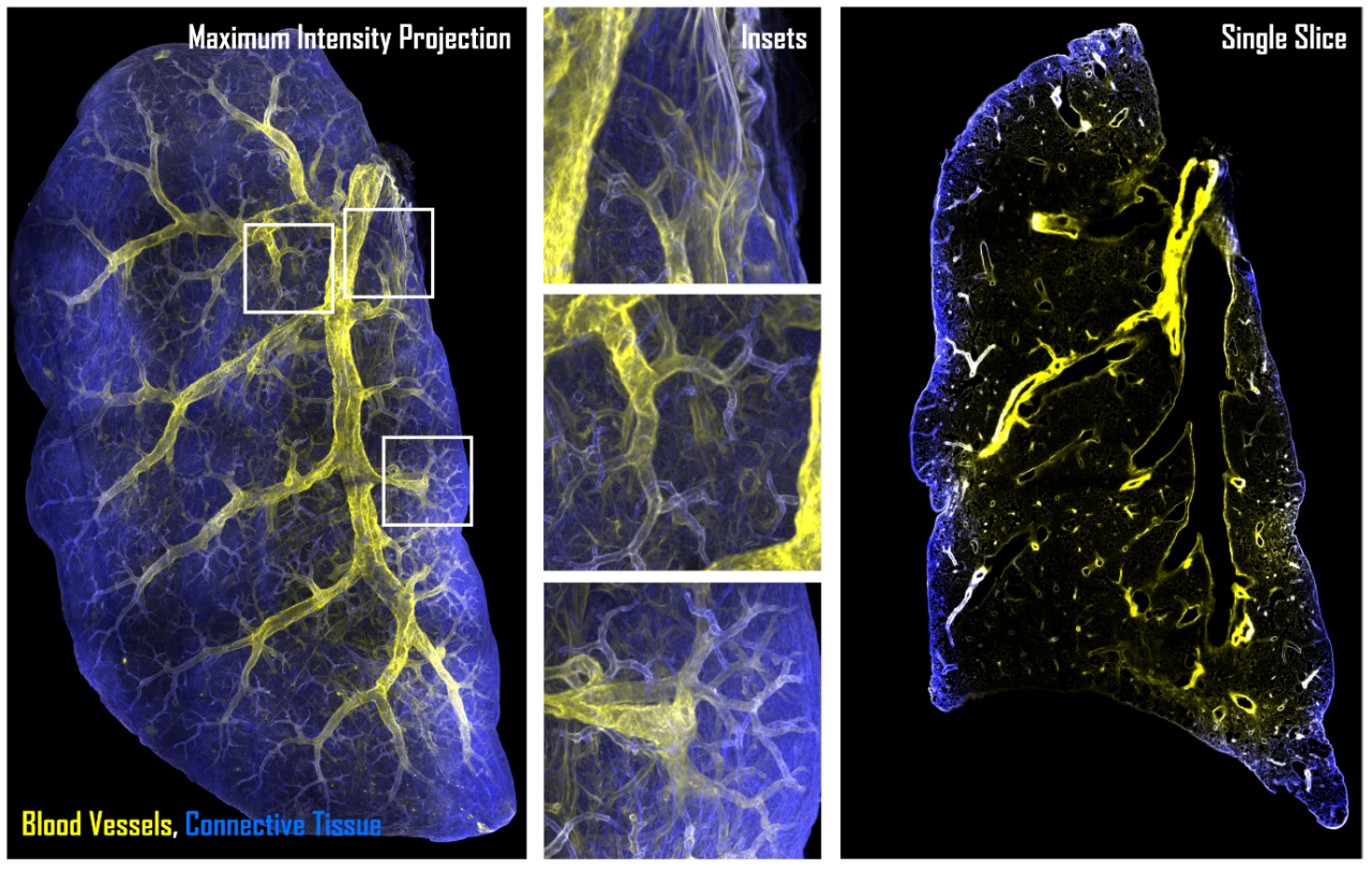 Intricate branching patterns of mouse lungs and blood vessels.