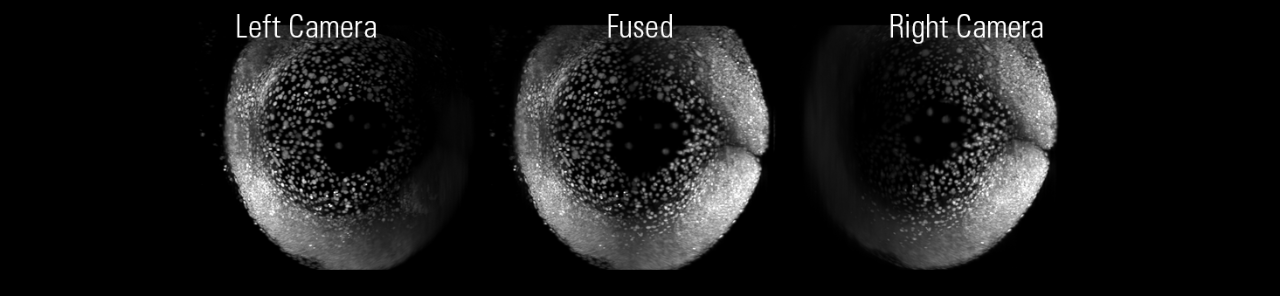 Zebrafish Expressing H2A::GFP