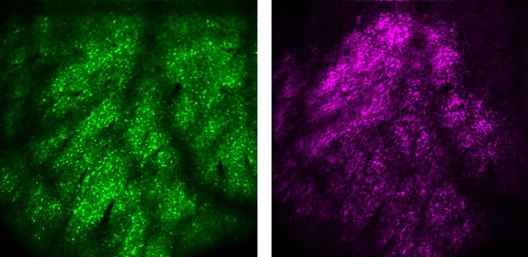 Co-expression of GCaMP6s (green) and soma-restricted C1V1-mRuby2 (magenta) in layer 5A neurons of mouse visual cortex at a depth of ~400 µm below the pia (right)