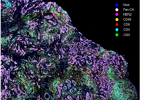 CellScape Spatial Profiling of Cancer Tissue