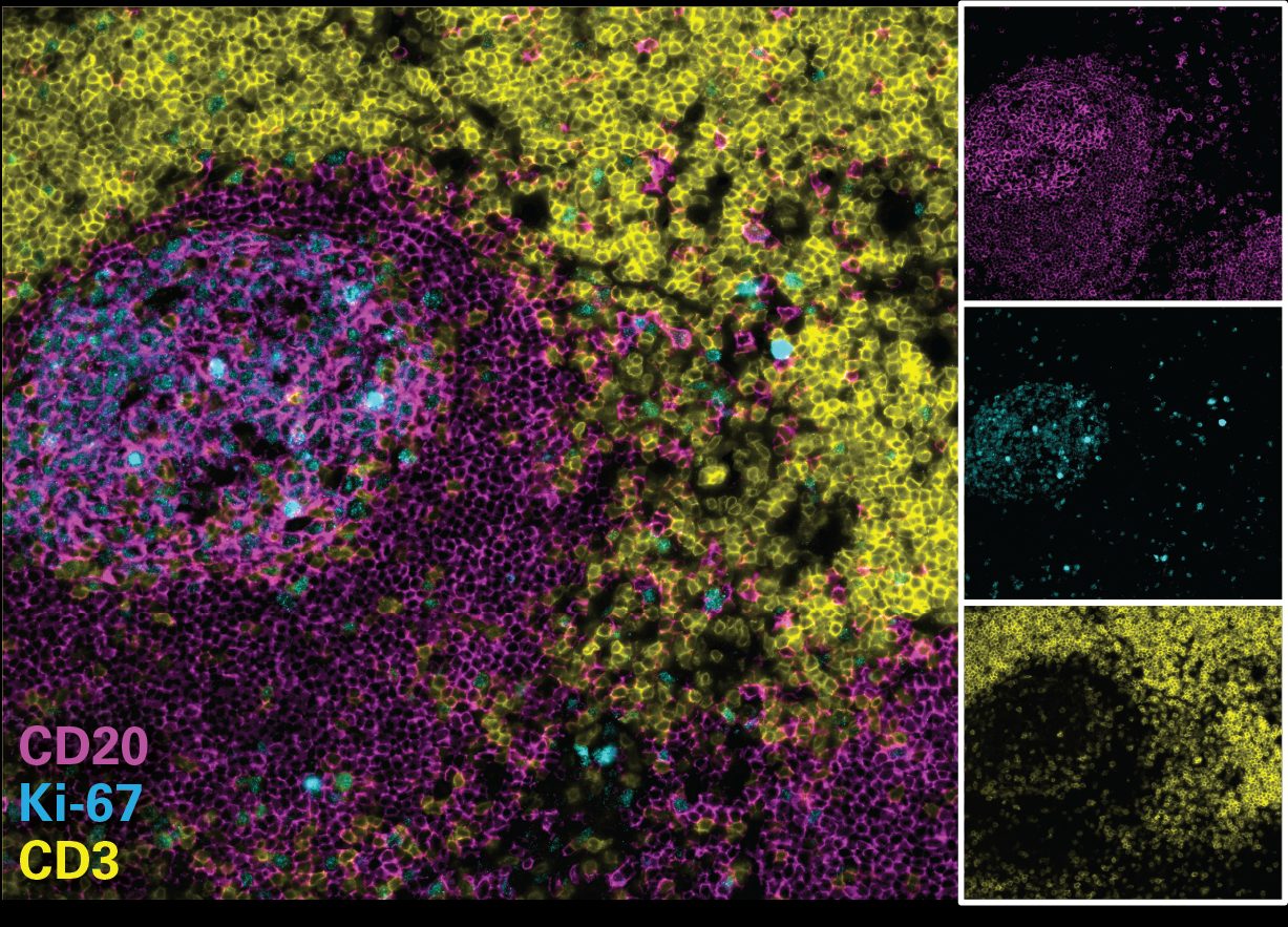 CellScape Rare Cell Detection